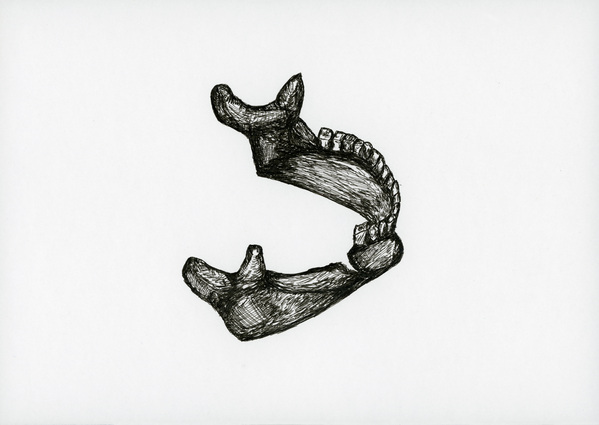 Broken Jaw by Jon David